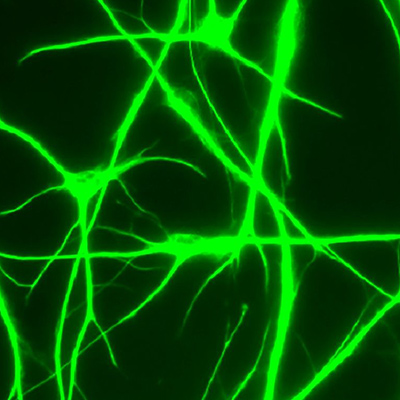 Differences in human, mouse brain cells have important implications for disease research